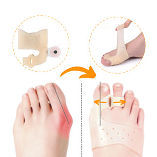Par de Corretor Ortopédico de Joanete Magnético de Silicone em Oferta na Shopee
