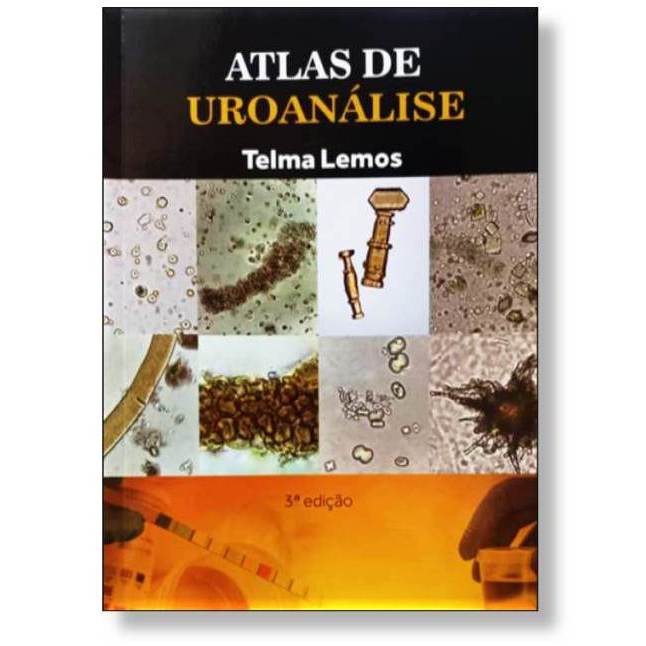 Atlas de Urinalise: Onde Comprar | BuscaProdutos