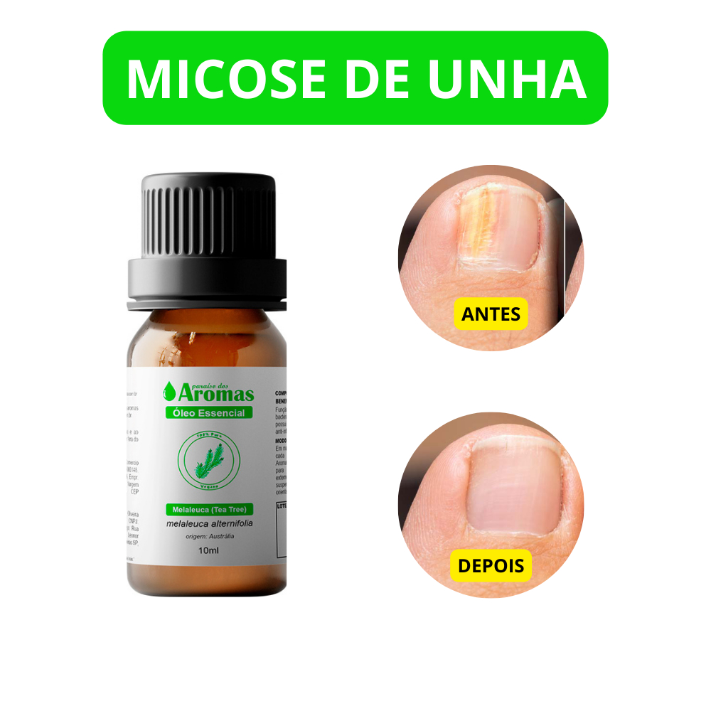 Óleo Essencial de Melaleuca/Tea Tree Paraíso dos Aromas 10ml para Aromaterapia | Ideal para uso em difusores e humificadores