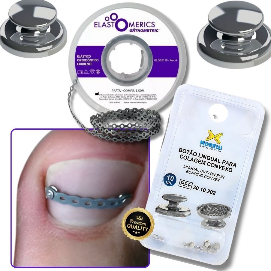 Kit Podologia C/ Botão Metal + Elástico Corrente 1,5MT  Unha Encravada - Correção
