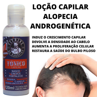 Tônico Capilar Para Fortalecimento Do Bulbo Capilar!!! em Oferta na Shopee