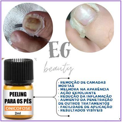 PELLING PARA PODOLOGIA, REMOÇÃO DE ONICOFOSES 2 ML