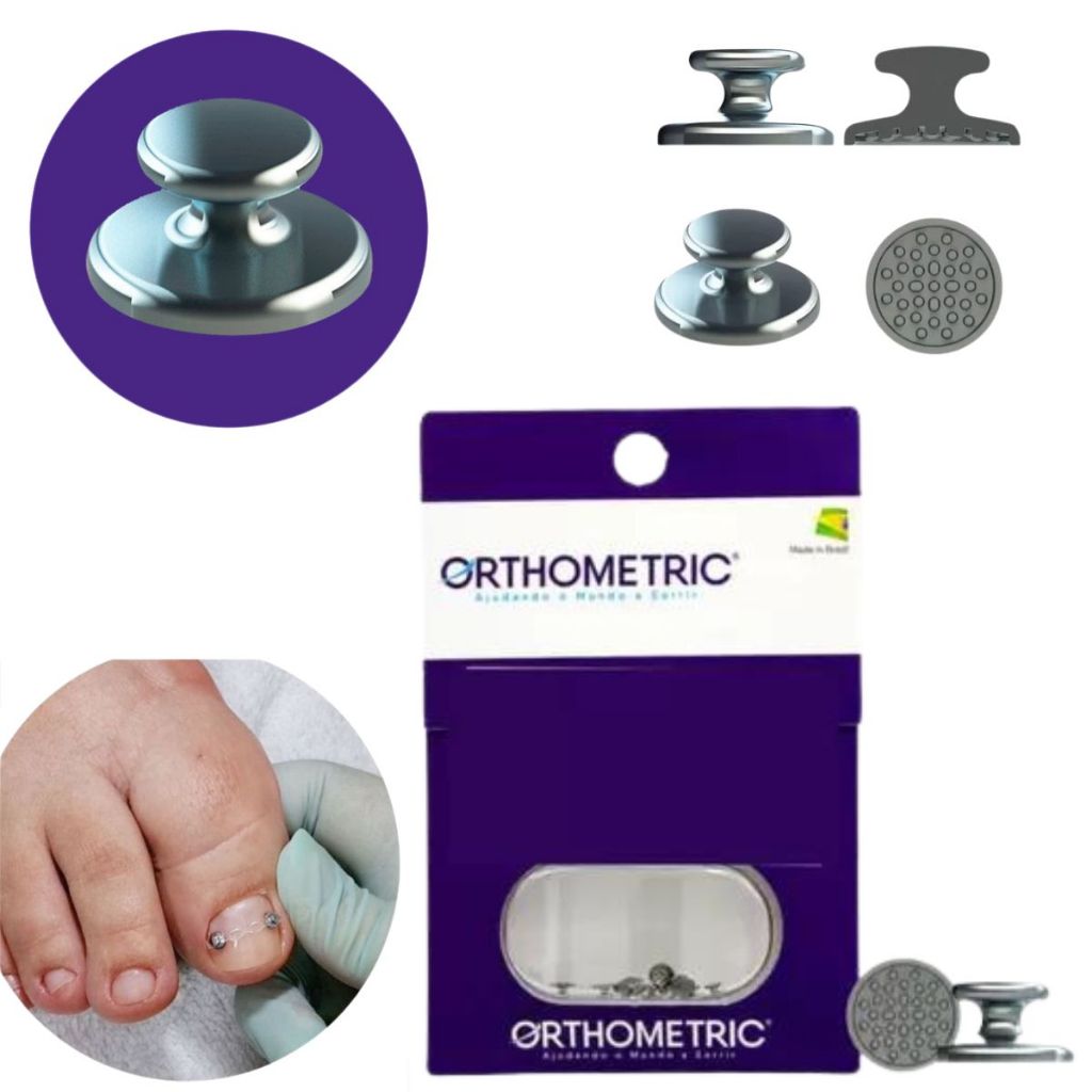 Botão Ortodontico: Onde Comprar | BuscaProdutos