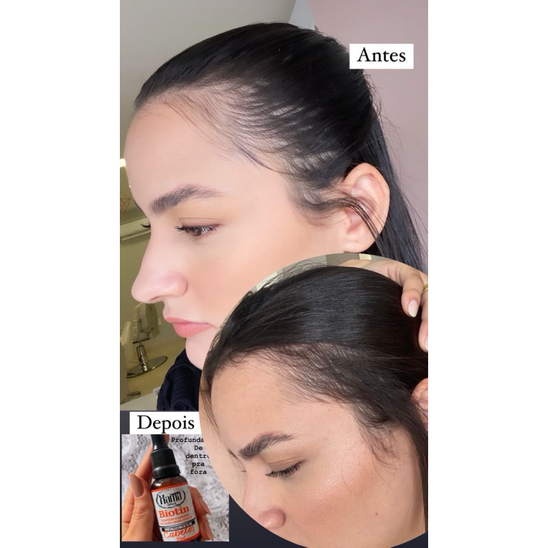 Tônico Pra Cabelo: Onde Comprar | BuscaProdutos