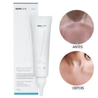 Derma Creme Regenerador Ozonizado Ozoncare Philozon 60g Original Ozônio Acalma Pós Sol Coceira em Oferta na Shopee
