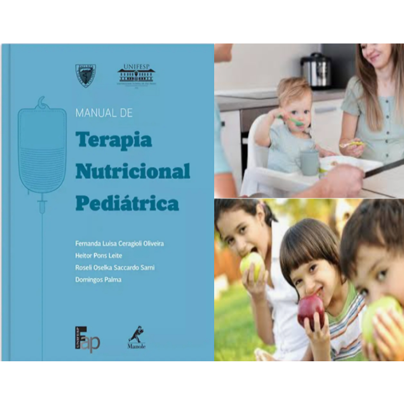 Manual de terapia nutricional pediátrica conhecimentos práticos de terapia nutricional infantil crianças e adolescentes