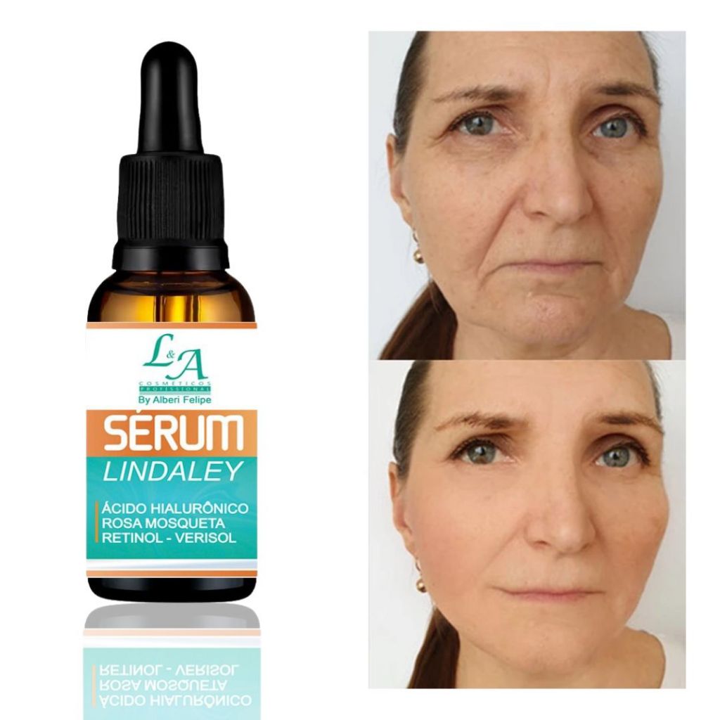 Sérum Lindaley Rico em Ácido Hialurônico / Retinol - Verisol / Rosa Mosqueta Antioxidante Vitamina C