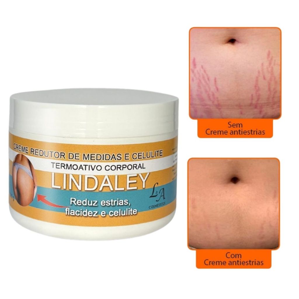 Creme AntiEstrias Removedor de Estrias 300g Lindaley