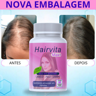 Biotina Cabelo Pele e Unhas - Crescimento Acelerado - Original - Queda Capilar - Envio Imediato em Oferta na Shopee