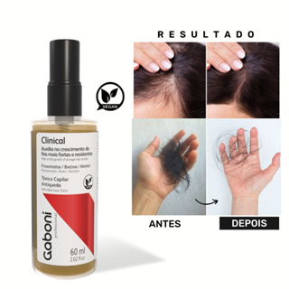 Tônico Capilar de Crescimento e Antiqueda Clinical 60ml Gaboni em Oferta na Shopee