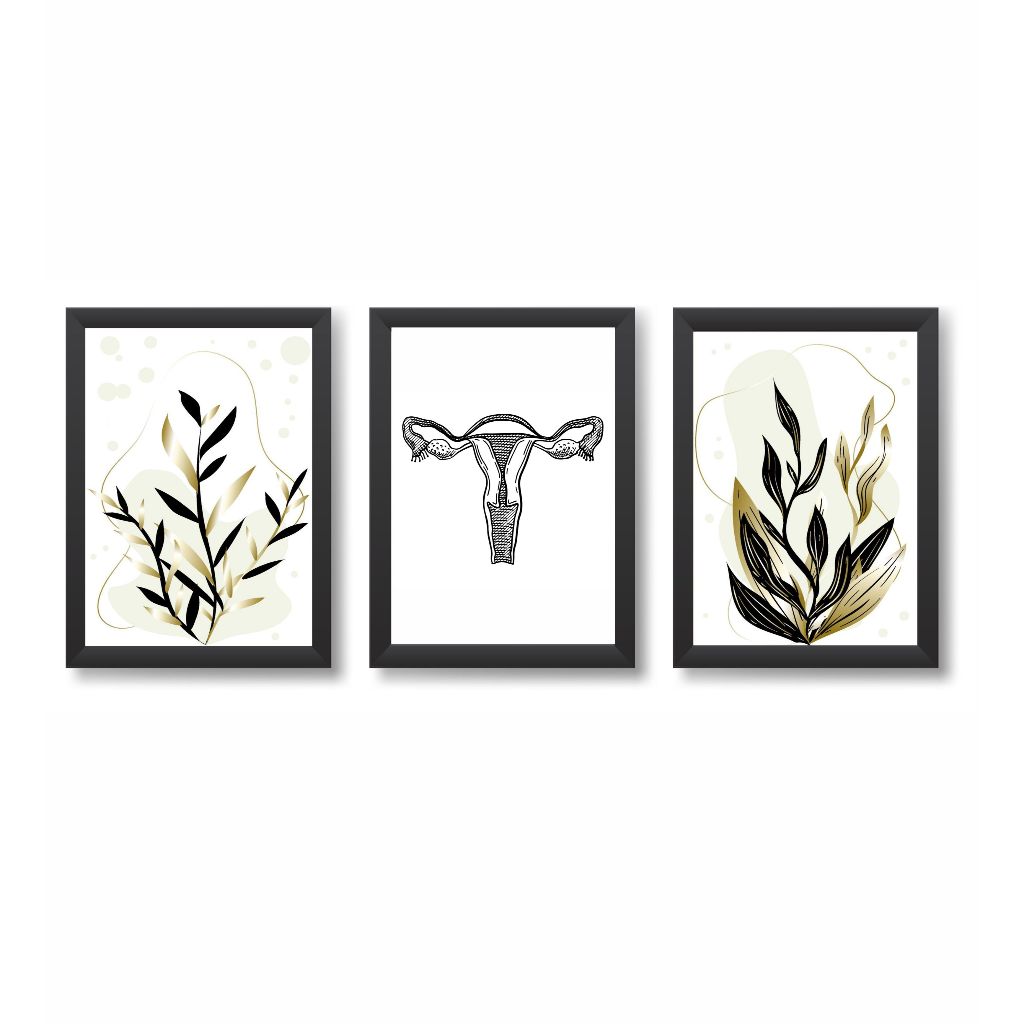 Kit 3 Quadros Decorativos Útero Ginecologia Obstetrícia Consultório Medicina Molduras 20x30cm Madeira