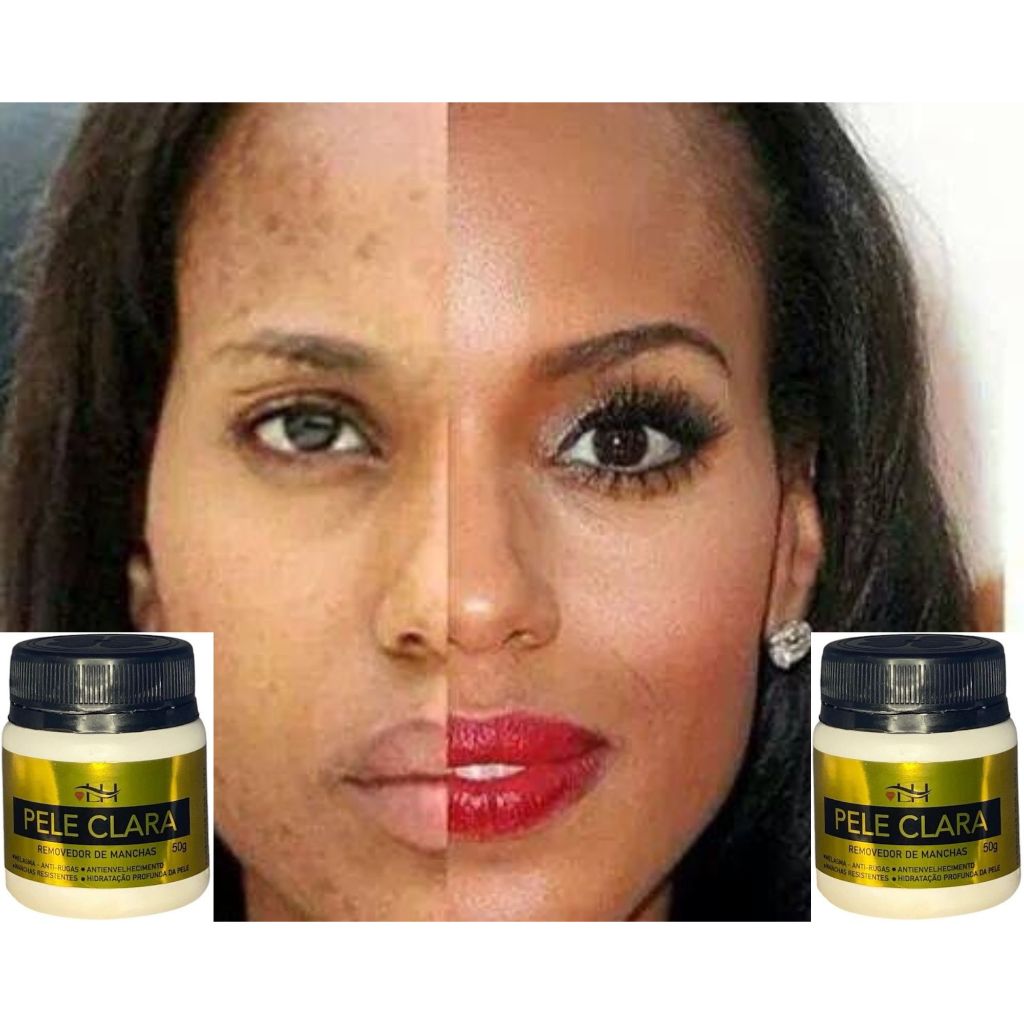 Pele Clara Creme Clareador 3 Un. Elimina Manchas 50g Original LissHair - PARA TODOS OS TIPOS DE PELE