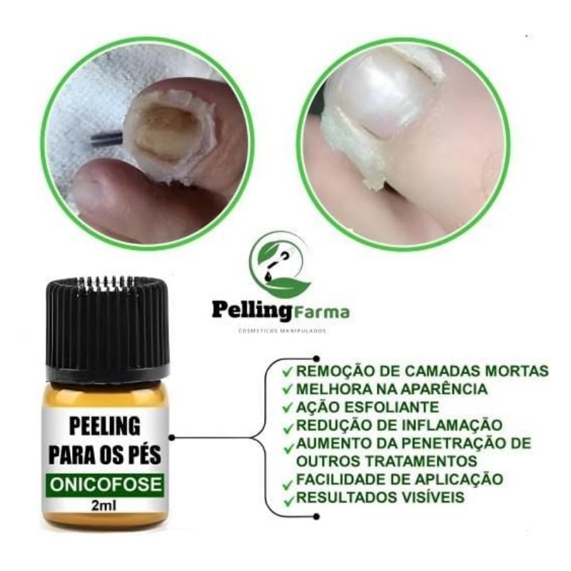 solução unhas Magic Podologia onicofose a base de Aloe e vera 2 ml em Oferta na Shopee