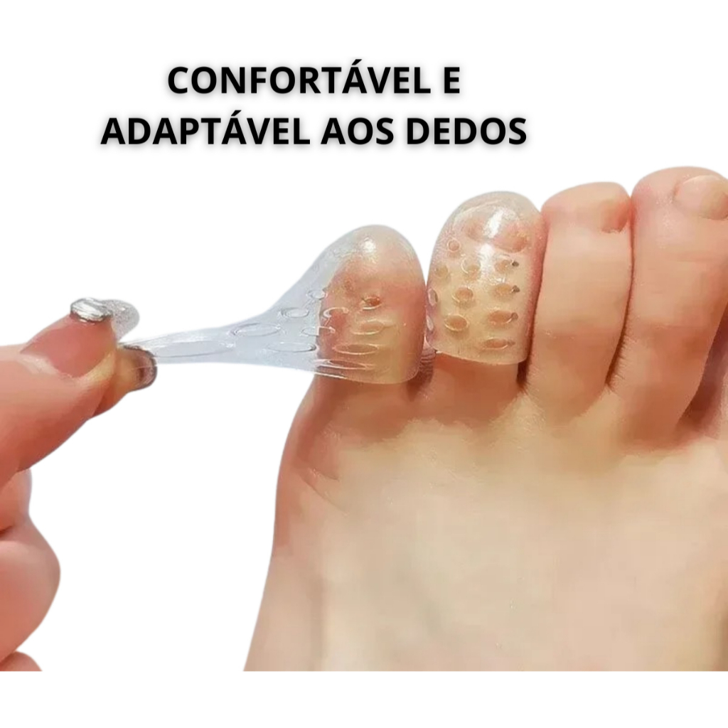 Kit Dedeiras de Pé em Silicone Proteção, Conforto Alívio para Calos, Unhas Encravadas e Atrito nos Dedos kit Ortopédico — imagem 2 de 2