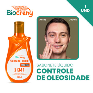 Sabonete Líquido Xô Espinha: Tratamento Eficaz para Acne, Oleosidade e Manchas na Pele em Oferta na Shopee