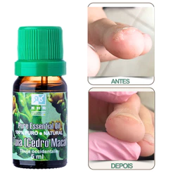 Óleo Essencial De Tuia (cedro Maça) 5ml - 100% Puro
