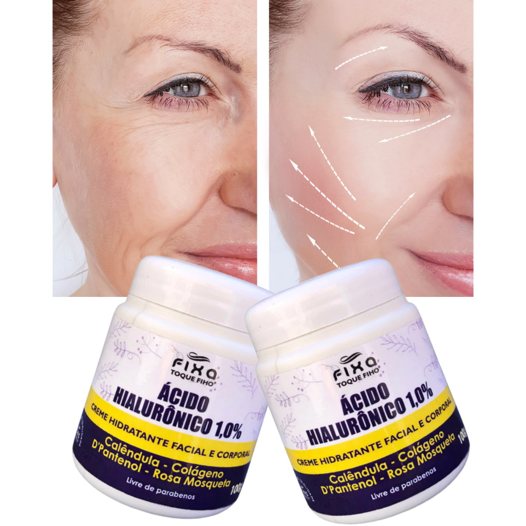 Creme Ácido Hialurônico Anti Rugas Colágeno E Rosa Mosqueta100g Hidratante Facial Reduz Linhas De Expressão