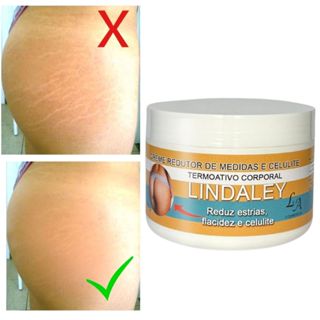 Creme Anti Estrias Removedor de Estrias 300g Lindaley Resultados Reais em Oferta na Shopee