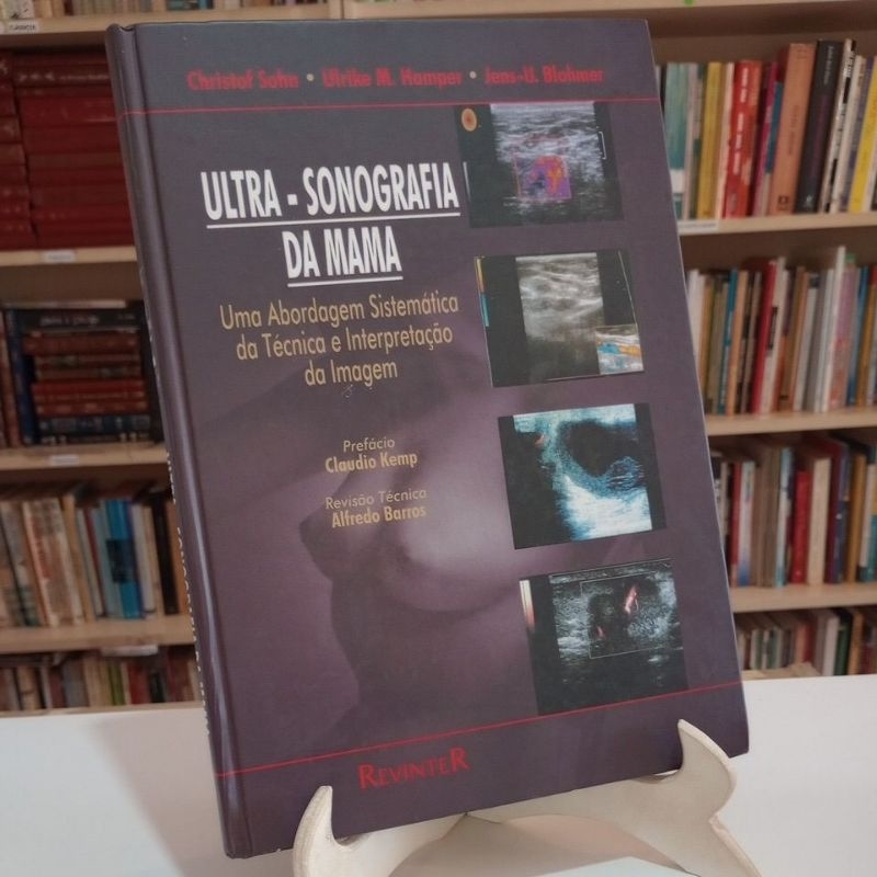 ultrassonografia da mama - Christof Sohn, Ulrike Hamper (livro radiologia)