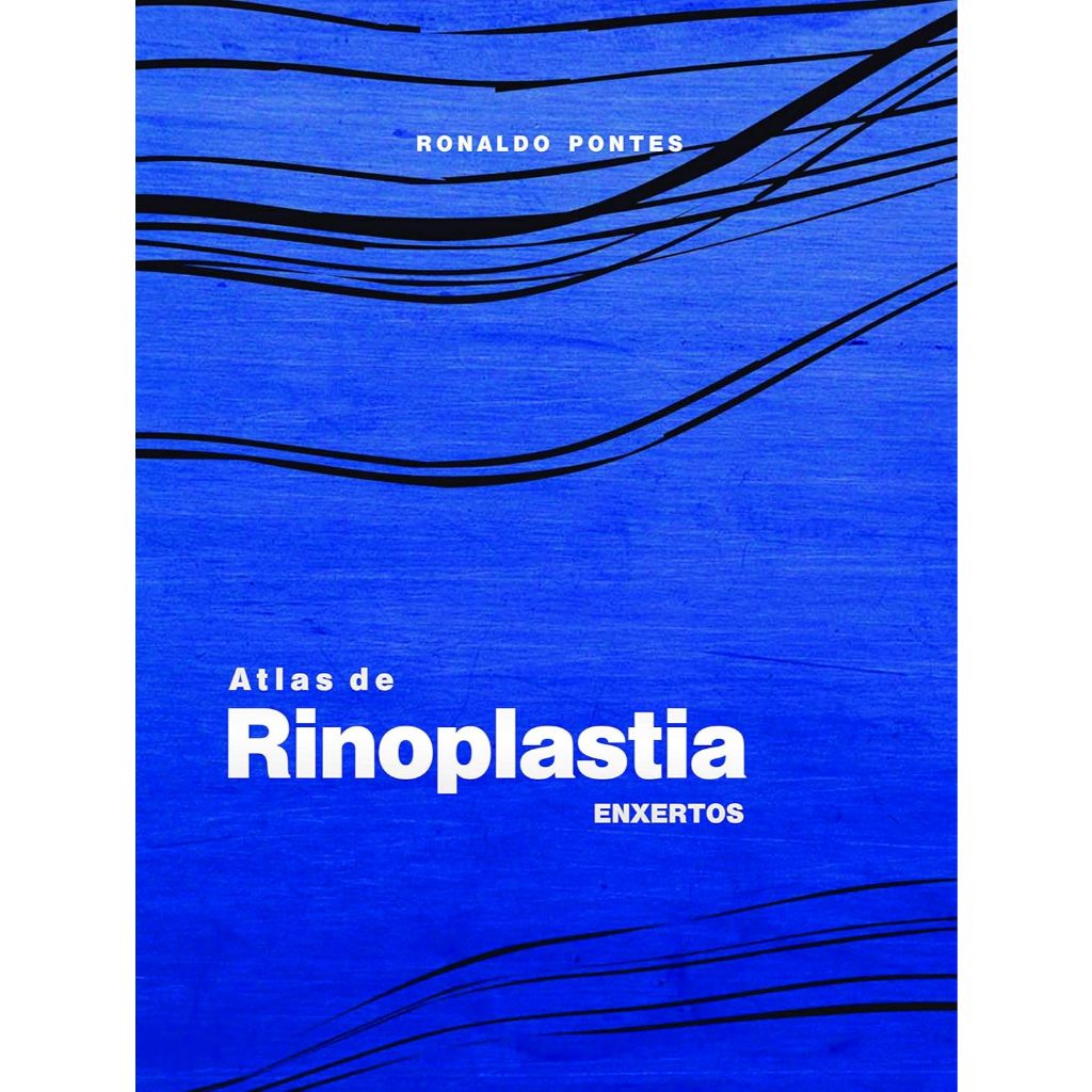 Atlas de Rinoplastia: Enxertos por Ronaldo Pontes