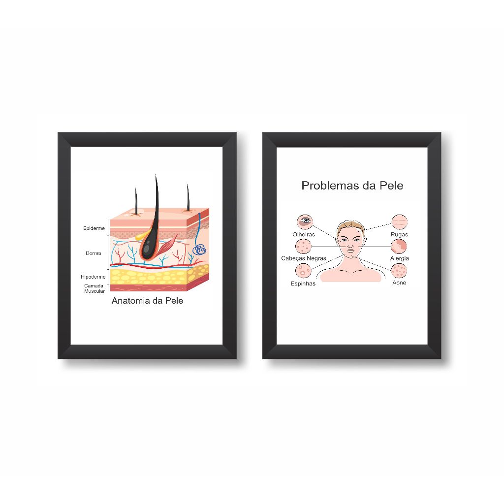 Kit 2 Quadros Decorativos Anatomia da Pele Decoração Consultório Médico Dermatologia Moldura 20x30cm Madeira