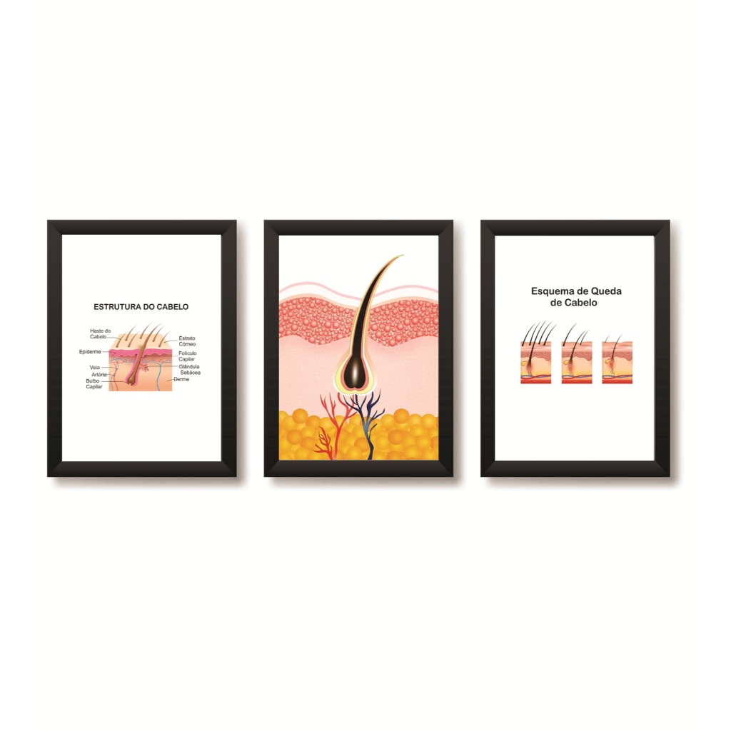 Kit 3 Quadros Decorativos Estrutura do Cabelo Tricologia Dermatologia Molduras 20x30cm Madeira Preta