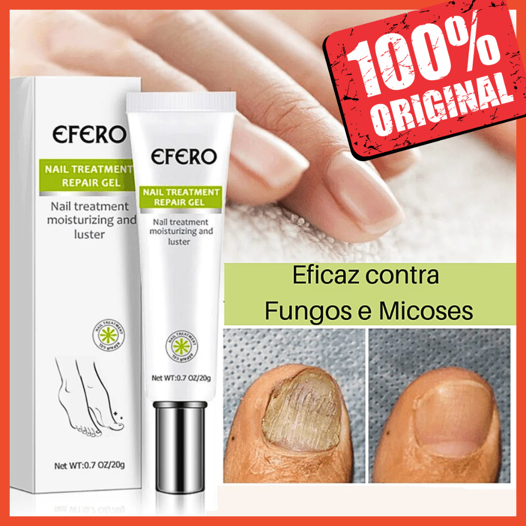 Gel Efero Nail Anti-Fungos para Unhas - Elimine Micose e Fortaleça Suas Unhas de Forma Definitiva