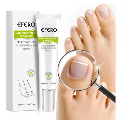 Efero Nail Repair Gel 20g - Tratamento Eficaz Contra Fungos e Bactérias nas Unhas dos Pés e Mãos!