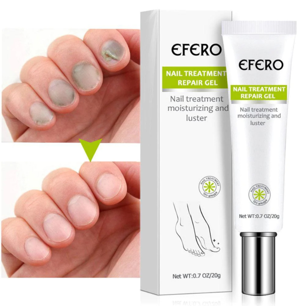 Unhas Saudáveis com Efero Nail - Gel Anti-Fungos para Crescimento e Fortalecimento das Unhas!