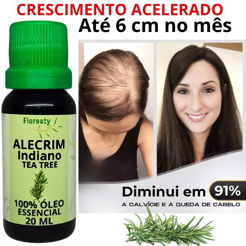 Óleo de Alecrim Essencial Indiano Puro 20 ml Crescimento Capilar | Aumento dos Fios | Cabelo Barba