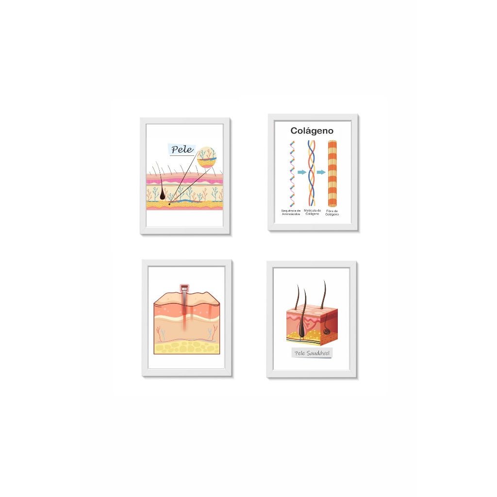 Kit 4 Quadros Decorativos Estrutura da Pele Decoração Consultório Médico Dermatologia Molduras 20x30cm Madeira