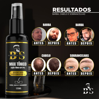 Max Tônico Capilar Cresce Cabelo Sobrancelha e Barba em Oferta na Shopee