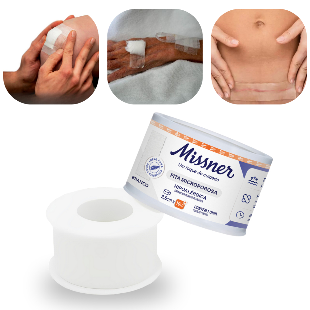Fita Micropore 2,5x10cm Branca Alta fixação Pós Cirúrgico Rinoplastia Missner em Oferta na Shopee