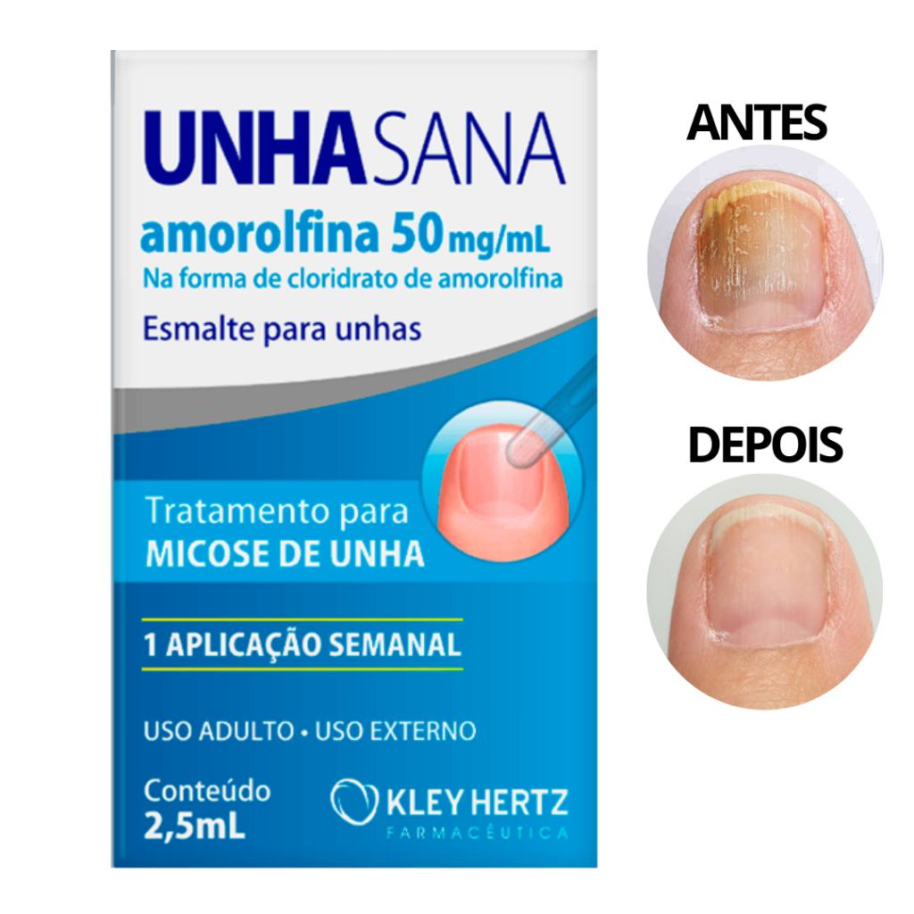 Unhasana Esmalte Micose 2,5ml Kley Heartz em Oferta na Shopee
