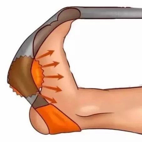 Kit Faixa Alongamento Tratamento Fascite Esporão + Bola Cravo.