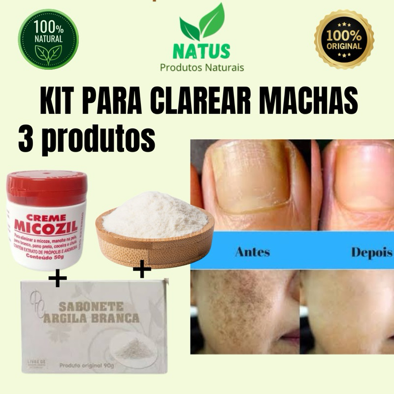 Kit para clarear manchas, melasma - 3 produtos (pomada micozil, sabonete de argila branca, 100g de argila branca