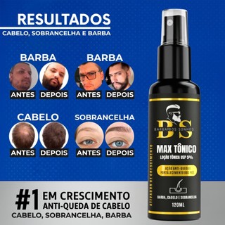 Tônico de Crescimento e Antiqueda para Cabelo, Barba e Sobrancelha – Barba dos Sonhos