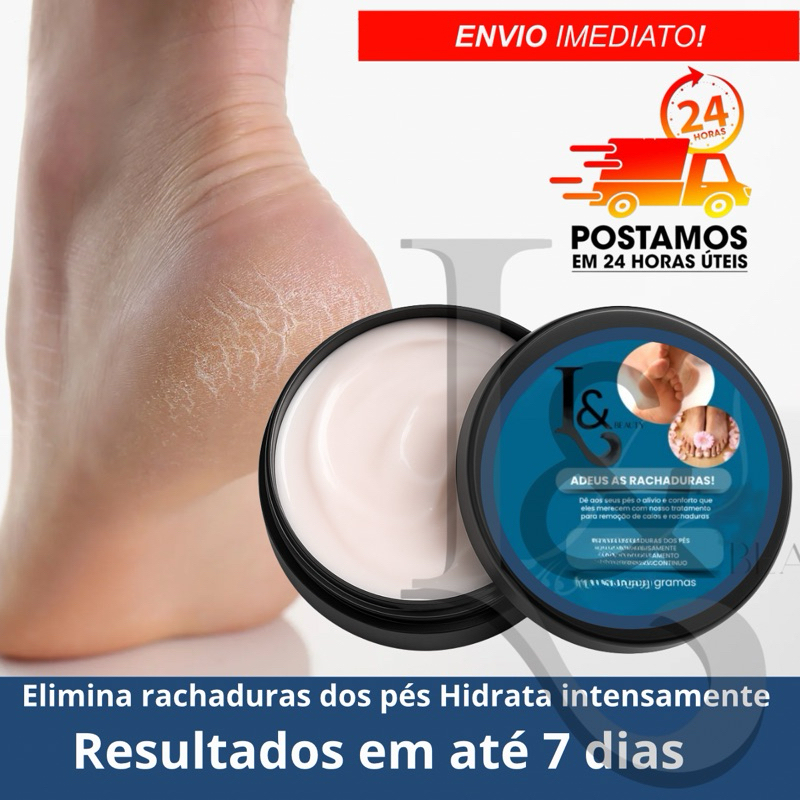 Creme Para Rachaduras Fissura Dos Pés Tratamento 150g