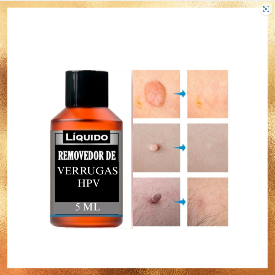 TIRA REMOVEDOR- FRASCO AMBAR tamanho 5ML ENVIO RAPIDO E EMBALAGEM DISCRETA
