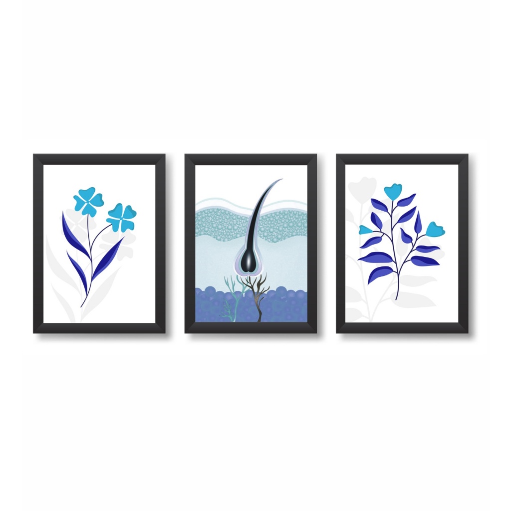 Kit 3 Quadros Decorativos Cabelo Tricologia Dermatologia Molduras 20x30cm Madeira Vidro Pretas
