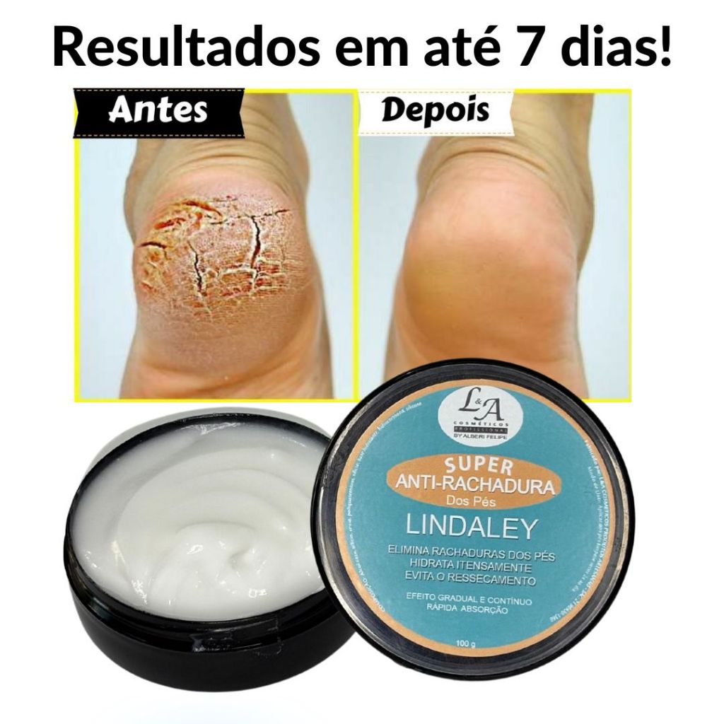 Creme Rachadura dos Pés: Onde Comprar | BuscaProdutos