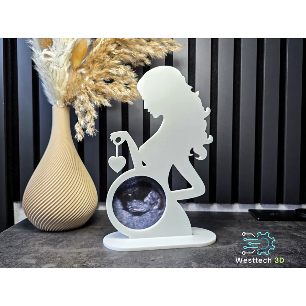 Suporte para Ultrassom de Gravidez em 3D – Porta-Retrato Personalizado, Presente Criativo