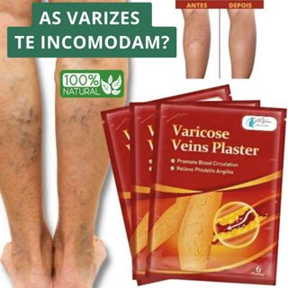 Kit 24 Adesivos Para Varizes Vasos e Veias em Oferta na Shopee
