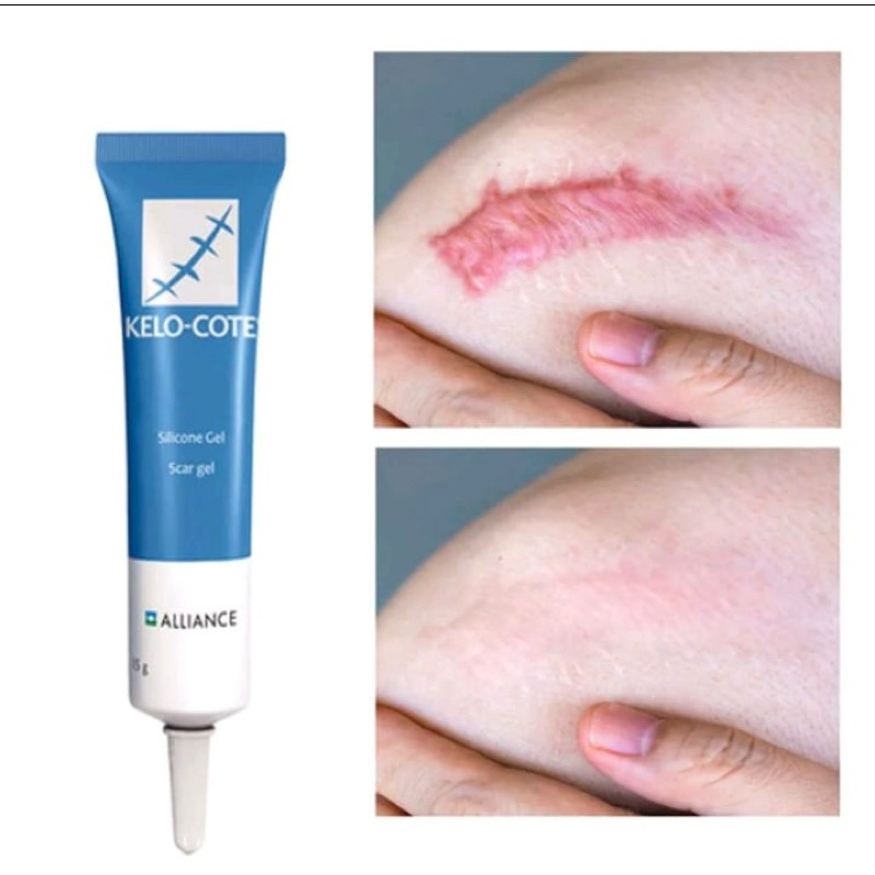 Kelo Cote Pomada: Onde Comprar | BuscaProdutos