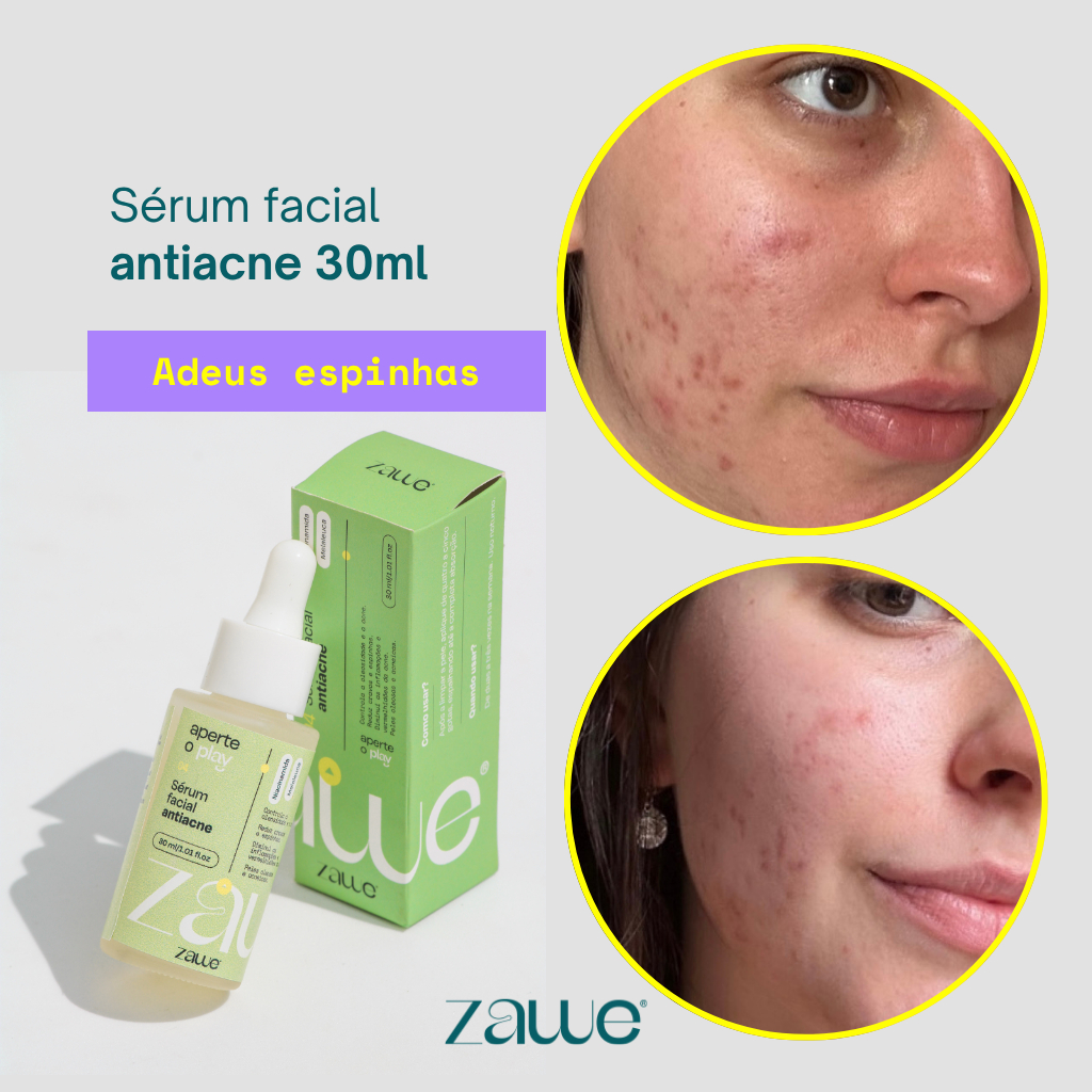 Sérum Anti Cravos e Espinhas: Onde Comprar | BuscaProdutos