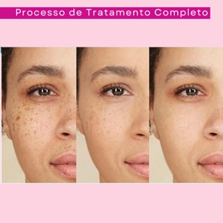 Kit Skincare Rosa Mosqueta Ultra Hidratante Rhenuks — imagem 2 de 2