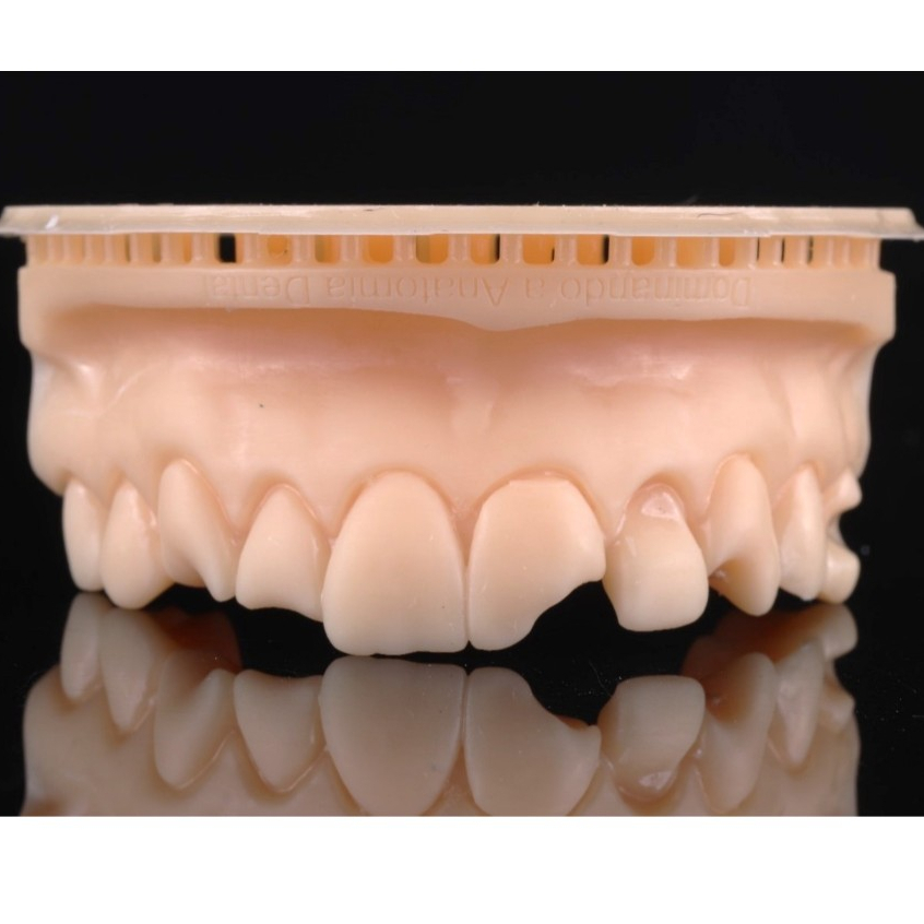 Modelo de treino - Restauração em resina - Todas classificações - Anatomia Oclusal- Restaurar- Preparar- em Oferta na Shopee
