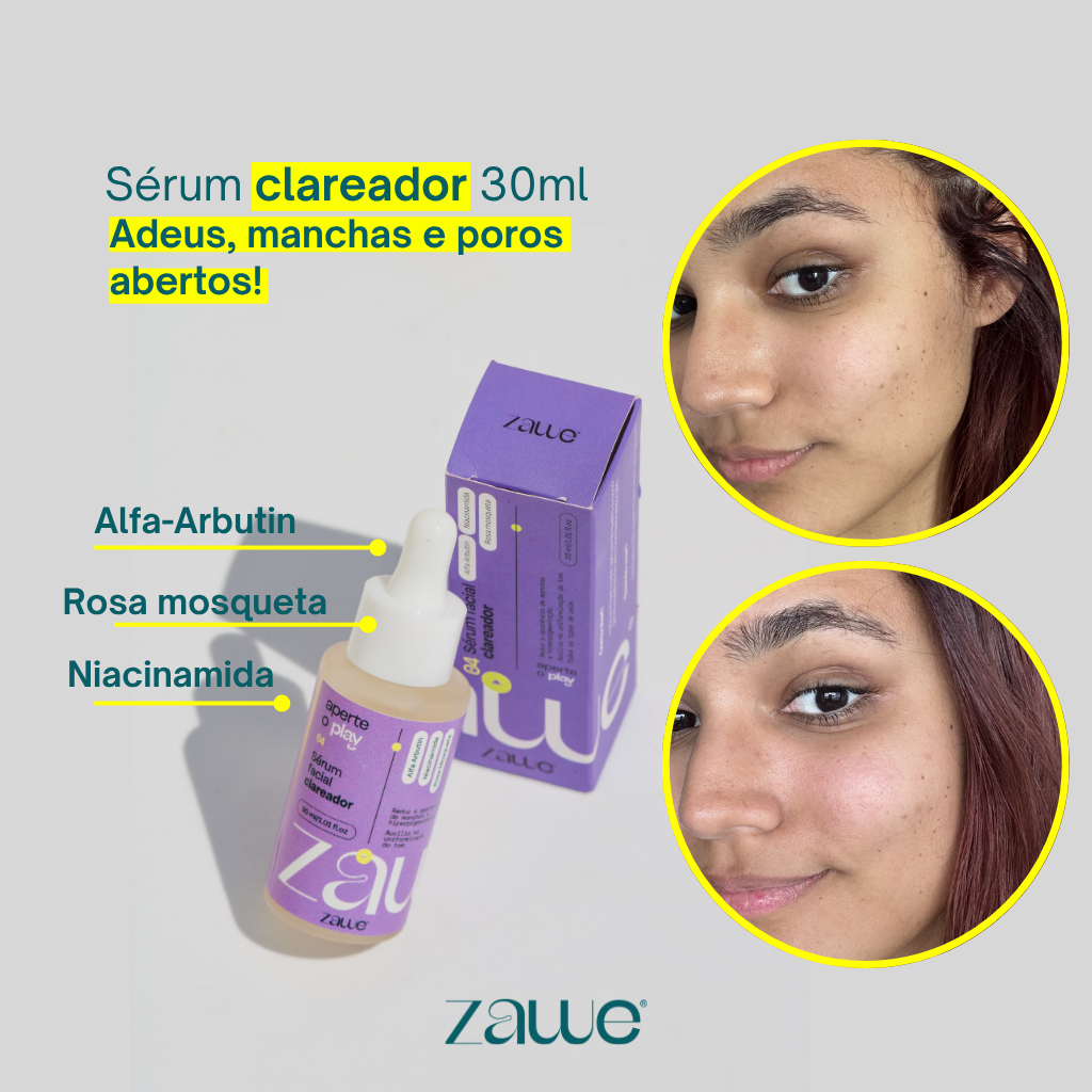 Serum facial niacinamida e rosa mosqueta clareador de manchas anti acne cravos e espinhas 30ml