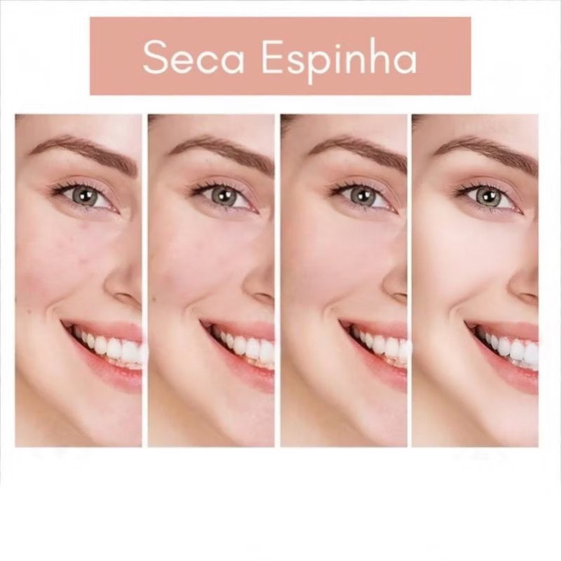 Kit 36/72 Adesivos Para Espinhas Acnes Hidrocoloide — imagem 2 de 2