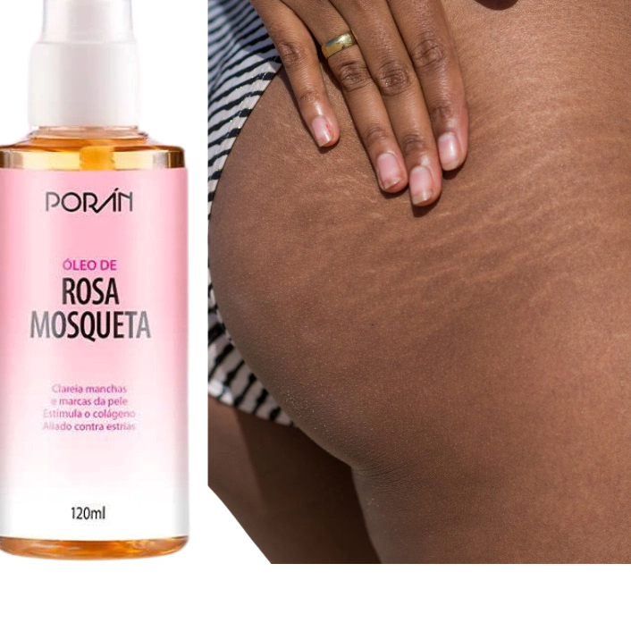 Kit 2 Óleo de Rosa Mosqueta Corporal Reduz e Suaviza Estrias Estimula o Colágeno 100% Puro 120ML